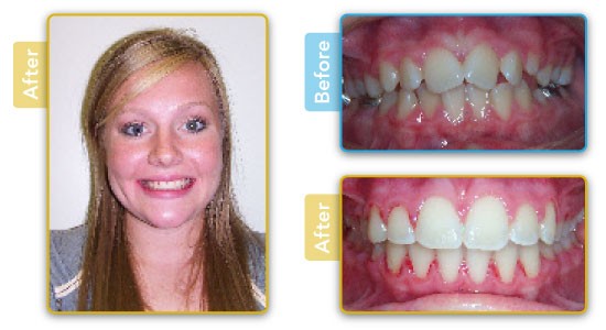 Before & After Patient Photos